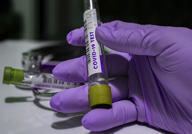 Вирусологи рассказали о частых ошибках при сдаче теста на COVID-19